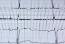 polaris pulse opportunity beam