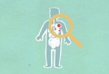 why how kialodenzydaisis kills